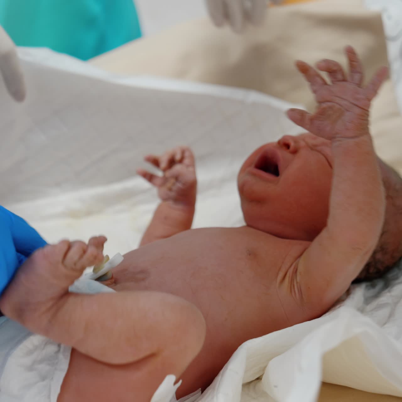 Un neonato viene spogliato dai medici. Il bambino è infelice e piange agitando le mani. Primo piano