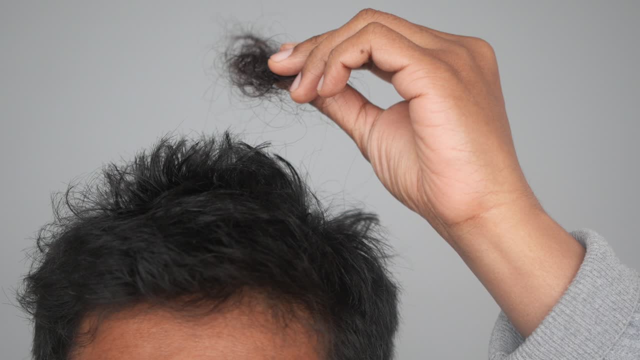 hombre examinando su pérdida de cabello