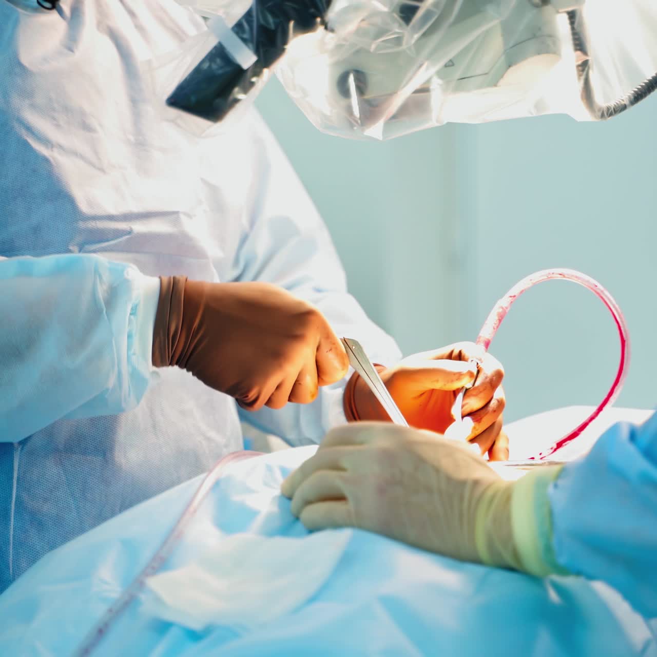 Neurosurgery in modern clinic. Professional surgeons performing an operation. Medical tools and tubes in doctor's hands. Close-up.