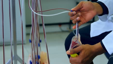 laboratory technician analyzing blood bag 4k