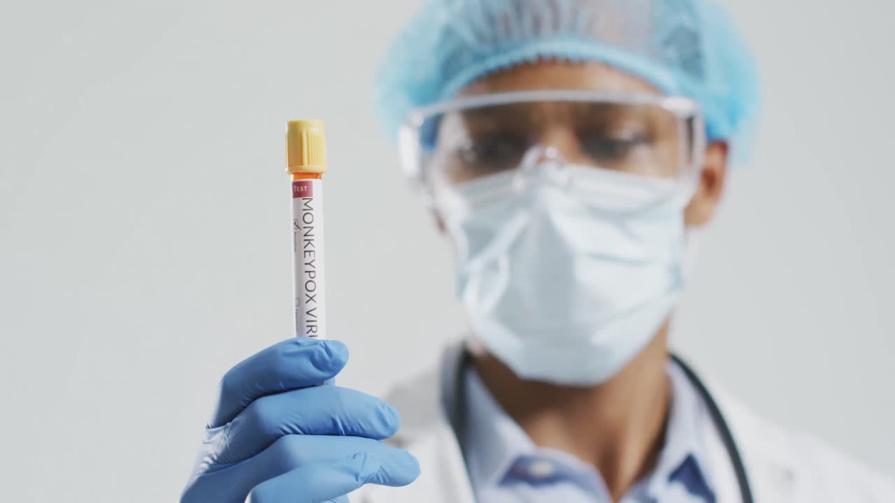 African american male doctor wearing face mask, holding vial with monkeypox virus
