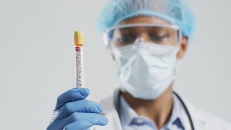 médico afroamericano de sexo masculino con máscara facial, sosteniendo un vial con el virus de la viruela del mono