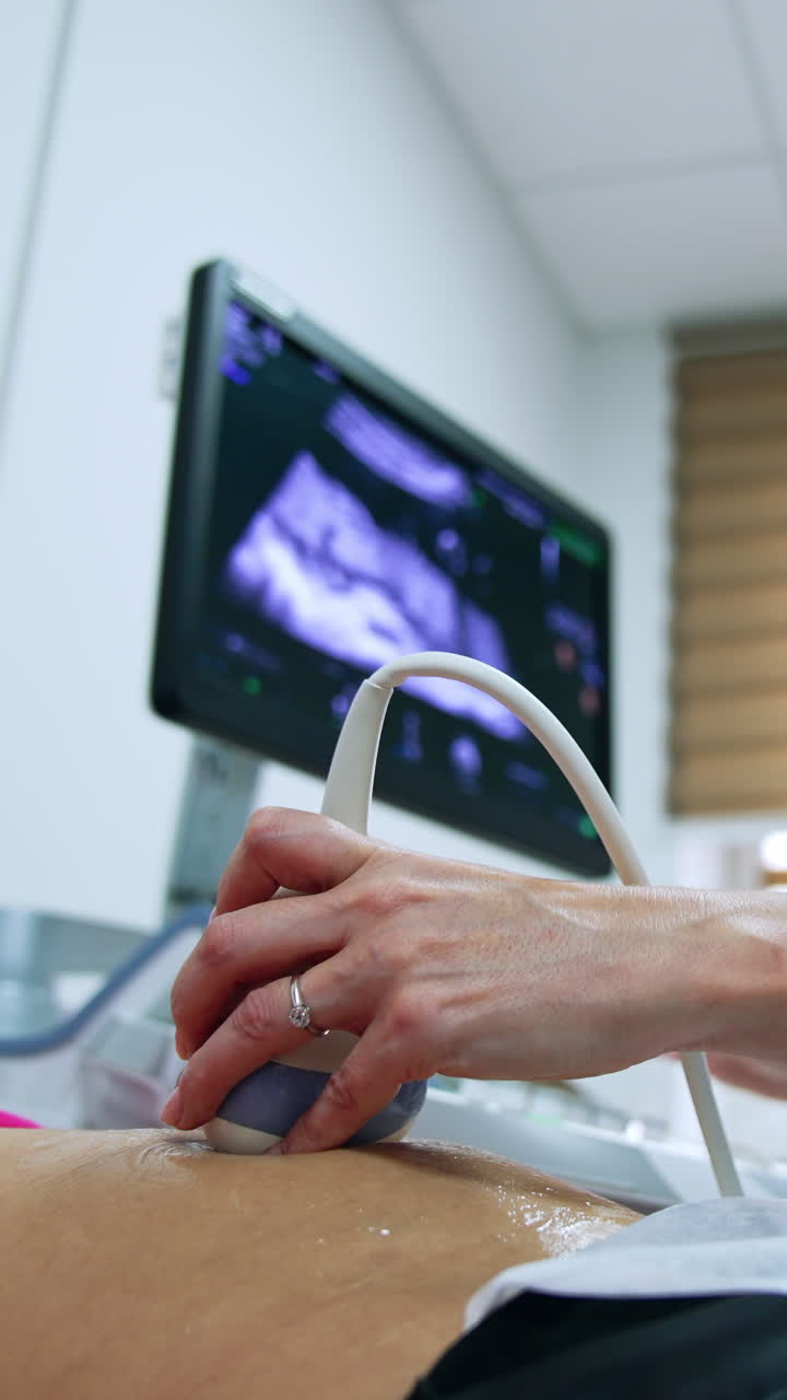 Female brunette doctor check the pregnancy of a patient at ultrasonic equipment. Specialist holds the transducer on woman's belly. Low angle view.. Vertical video