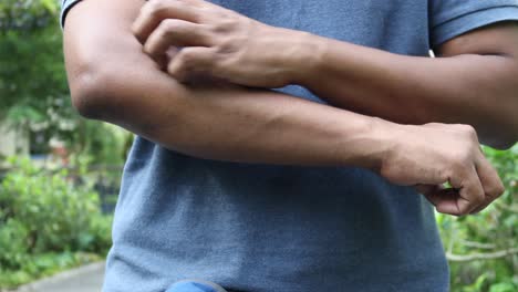 man scratching his arm