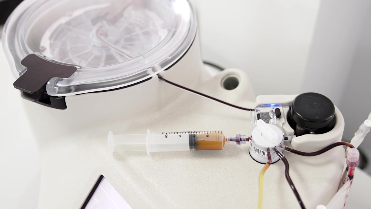 Machine médicale avancée avec centrifugeuse produisant du plasma à partir de sang. Préparation de concentré de plasma pour la thérapie PRP. Vue de dessus