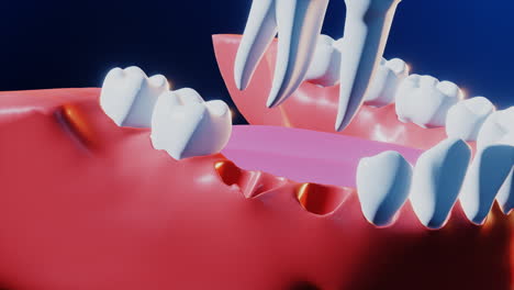 Tooth medical dental implant process