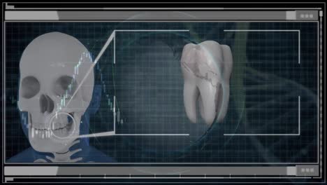 animation of skull, globe, tooth and diverse data processing on digital screen