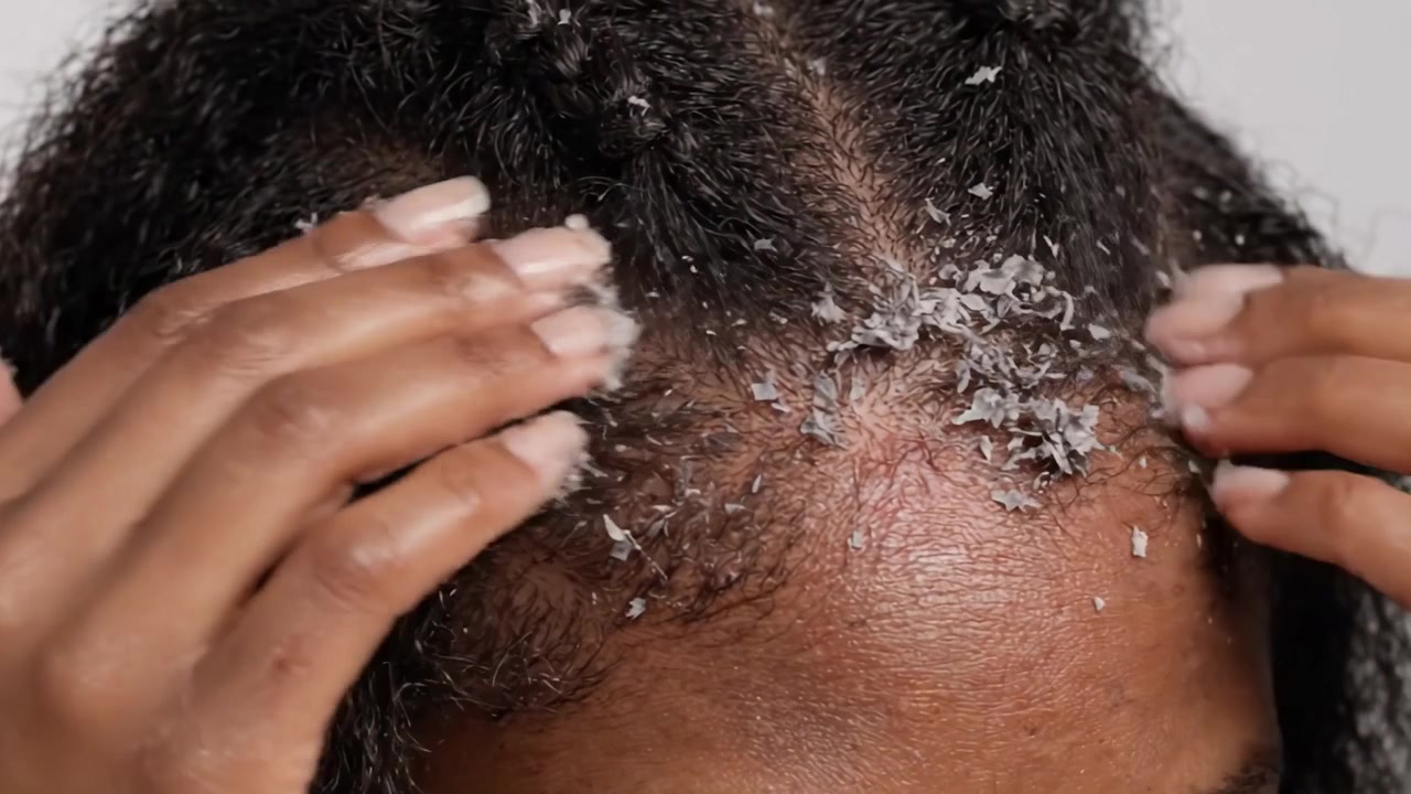 A Close-Up View of Scalp Scrub Application: Nurturing Natural Hair with Exfoliation Techniques for Healthy Growth and Scalp Care
