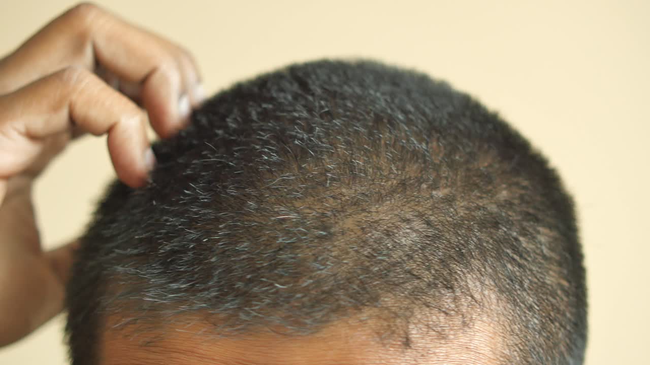 머리를 만지는 사람의 근접 사진