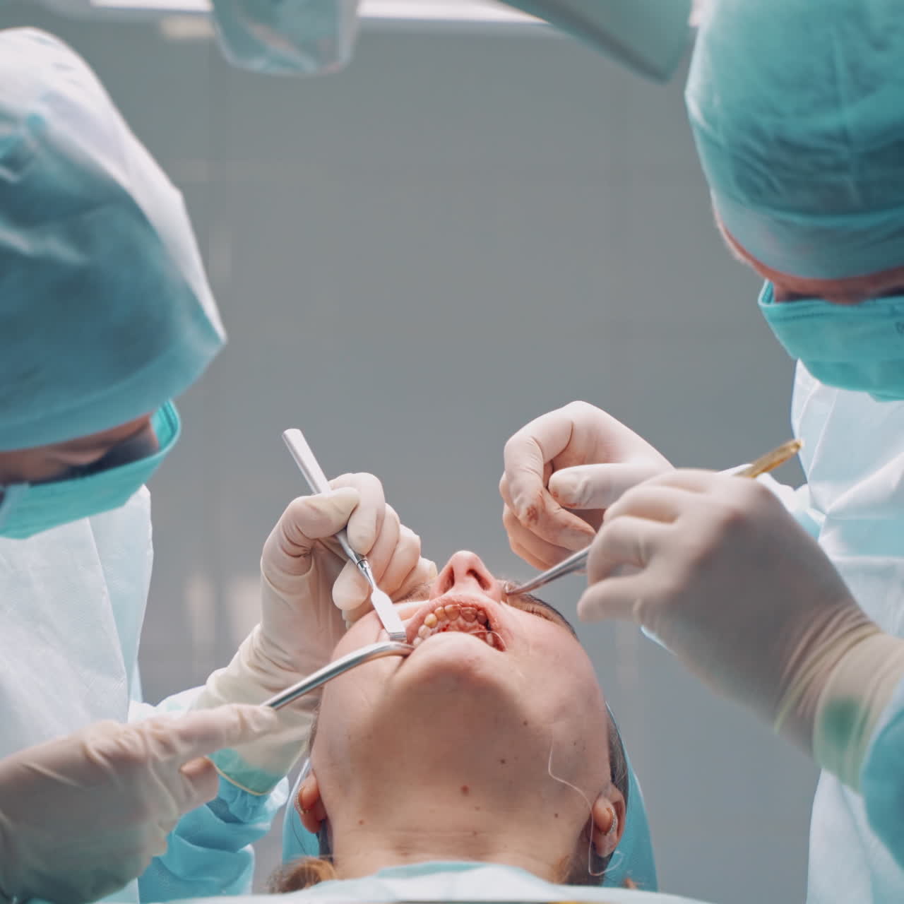 Dental implant surgery. Dentists during surgery for implant placement