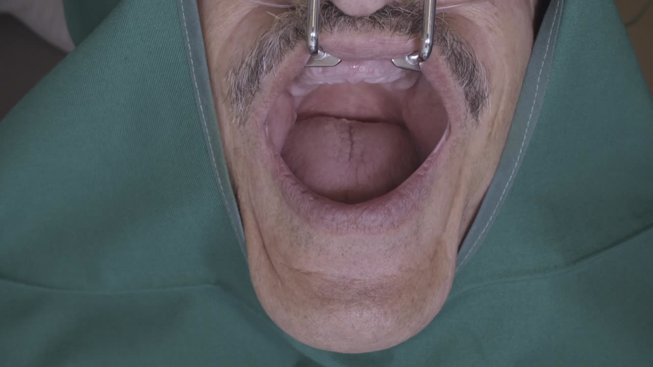 dentist applies dentures to a patient, preparing for fitting and adjustment.