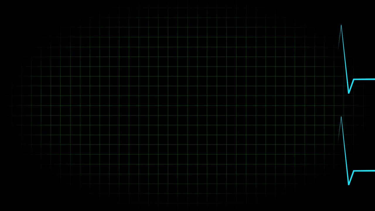 electrocardiograma osciloscopio forma de onda animación gráficos de movimiento