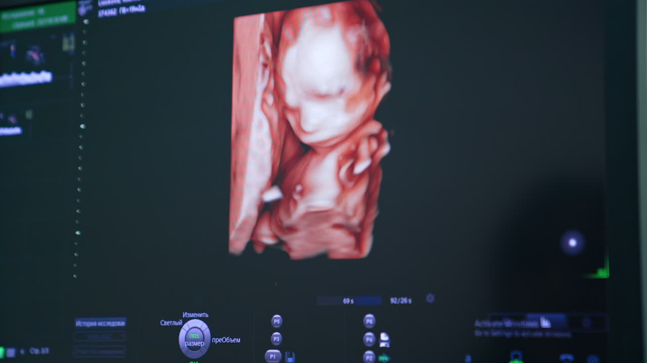 Little unborn baby image moving on the monitor of ultrasonic equipment. Close up. Pregnancy examination.