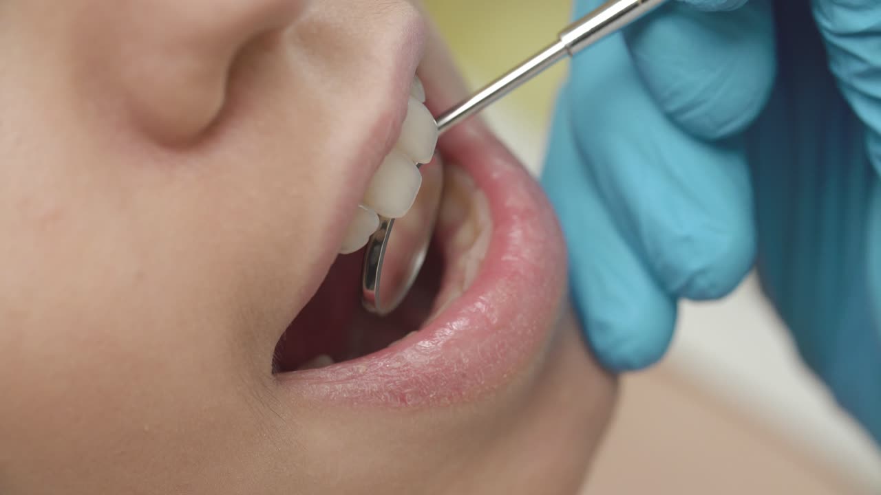 Dental Examination Close-Up