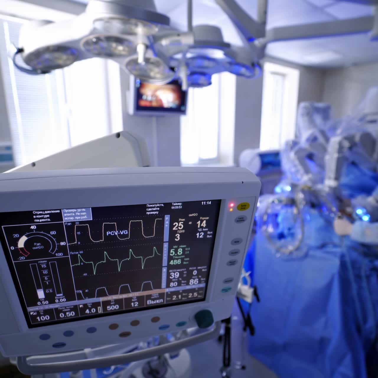 Monitor per la ventilazione polmonare artificiale in terapia intensiva. Gruppo di chirurghi in sala operatoria con attrezzatura chirurgica