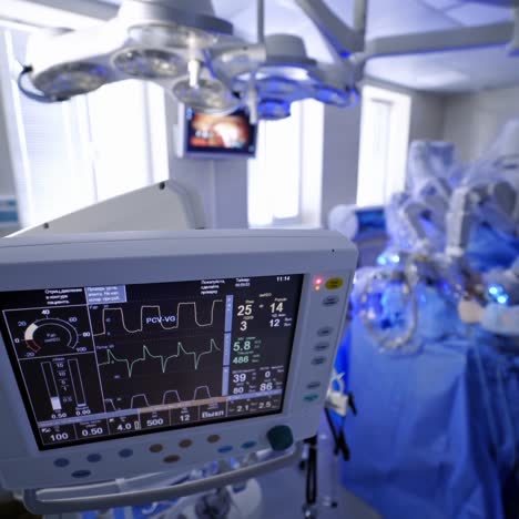 artificial lung ventilation monitor in the intensive care unit. group of surgeons in operating room with surgery equipment.