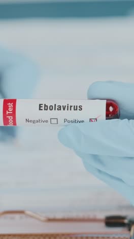 doctor displays positive blood test for ebola virus in a clinical setting