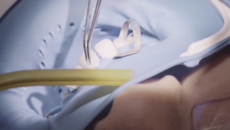 dental procedure: close-up view of teeth implant