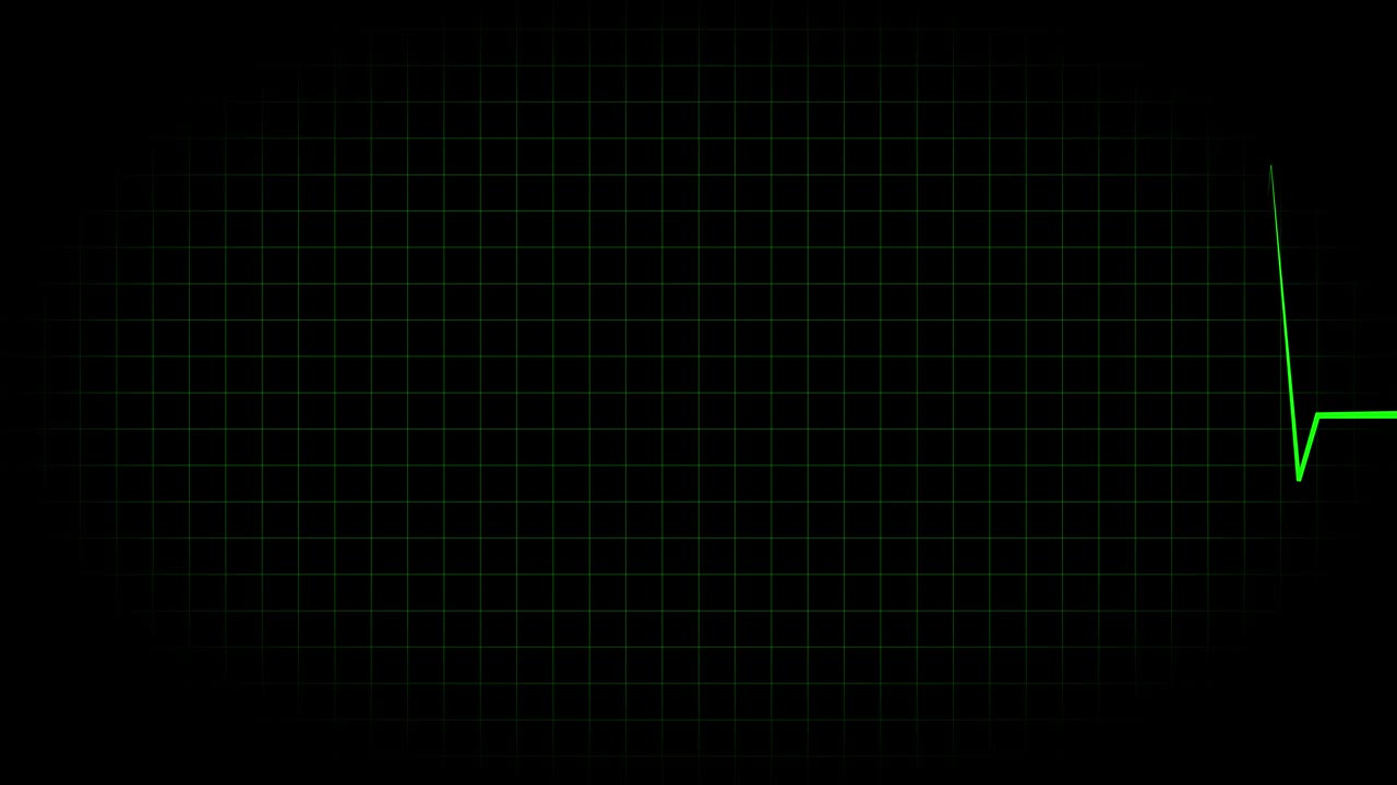 전기 심장 기록 오실로스코프 파동 형태 애니메이션 모션 그래픽