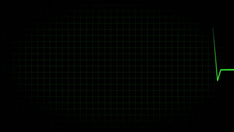 electrocardiograma osciloscopio forma de onda animación gráficos de movimiento