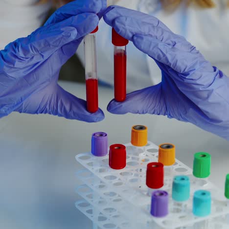 technician holding blood tube sample