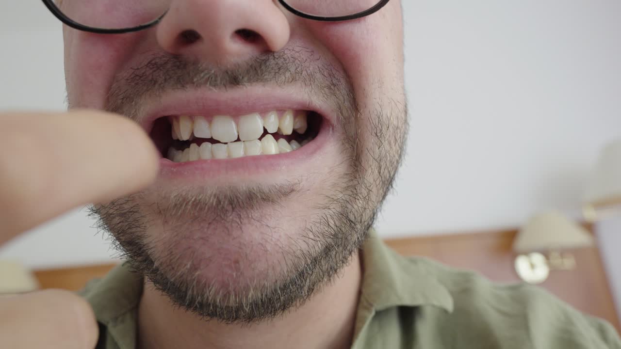 Close-up of a man pulling back his lip and pointing to a painful or damaged tooth. Indoor setting, possibly indicating dental discomfort or oral hygiene concern