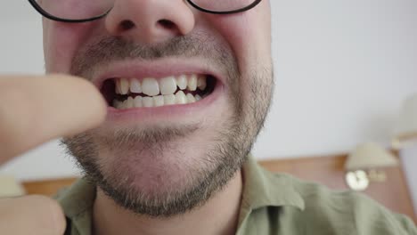 close-up of a man pulling back his lip and pointing to a painful or damaged tooth. indoor setting, possibly indicating dental discomfort or oral hygiene concern