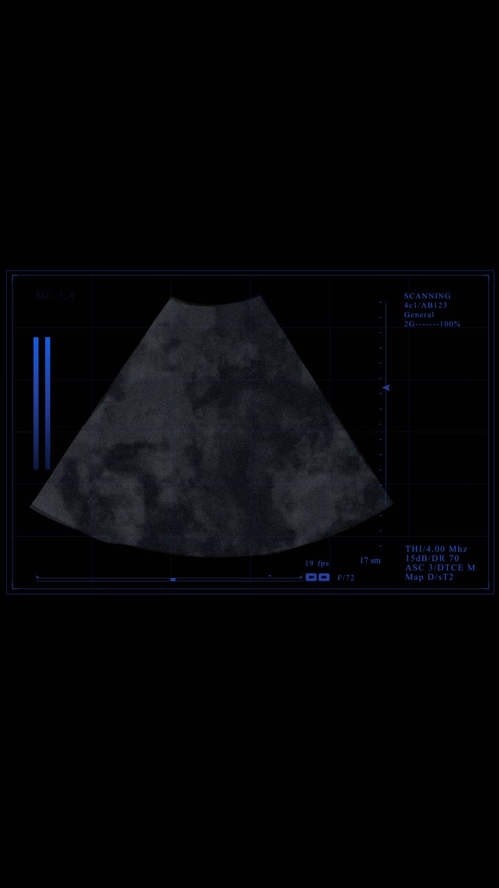 Abstract Medical Ultrasound Scan Screen Display