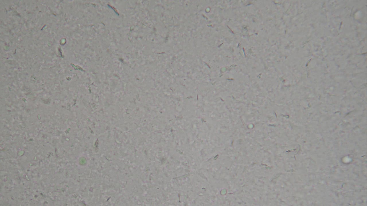 Shampoo under microscope with abrasive particles, microplastics