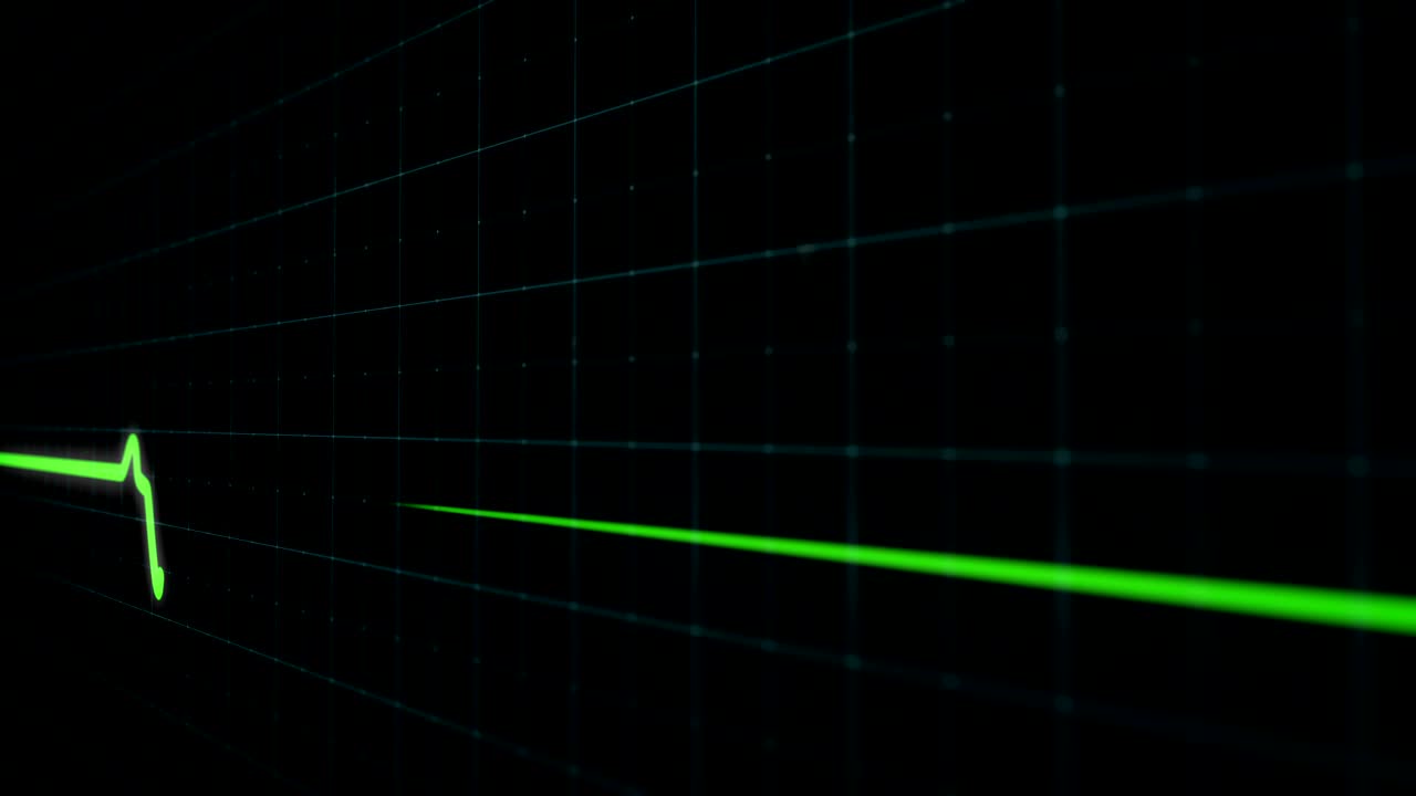 의료 모니터에서 심장 충동 순서