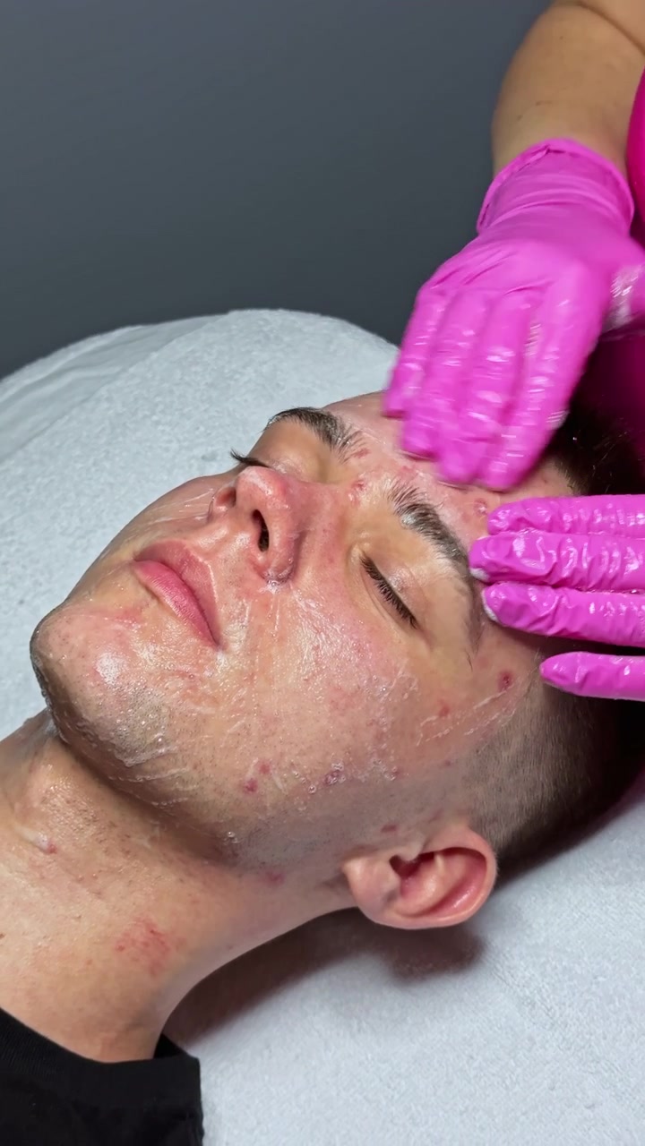 Sessione di trattamento viso in una clinica estetica con una cliente che riceve l'applicazione di una maschera in un ambiente rilassato, incentrato sulla routine di cura della pelle e sulle pratiche di benessere.