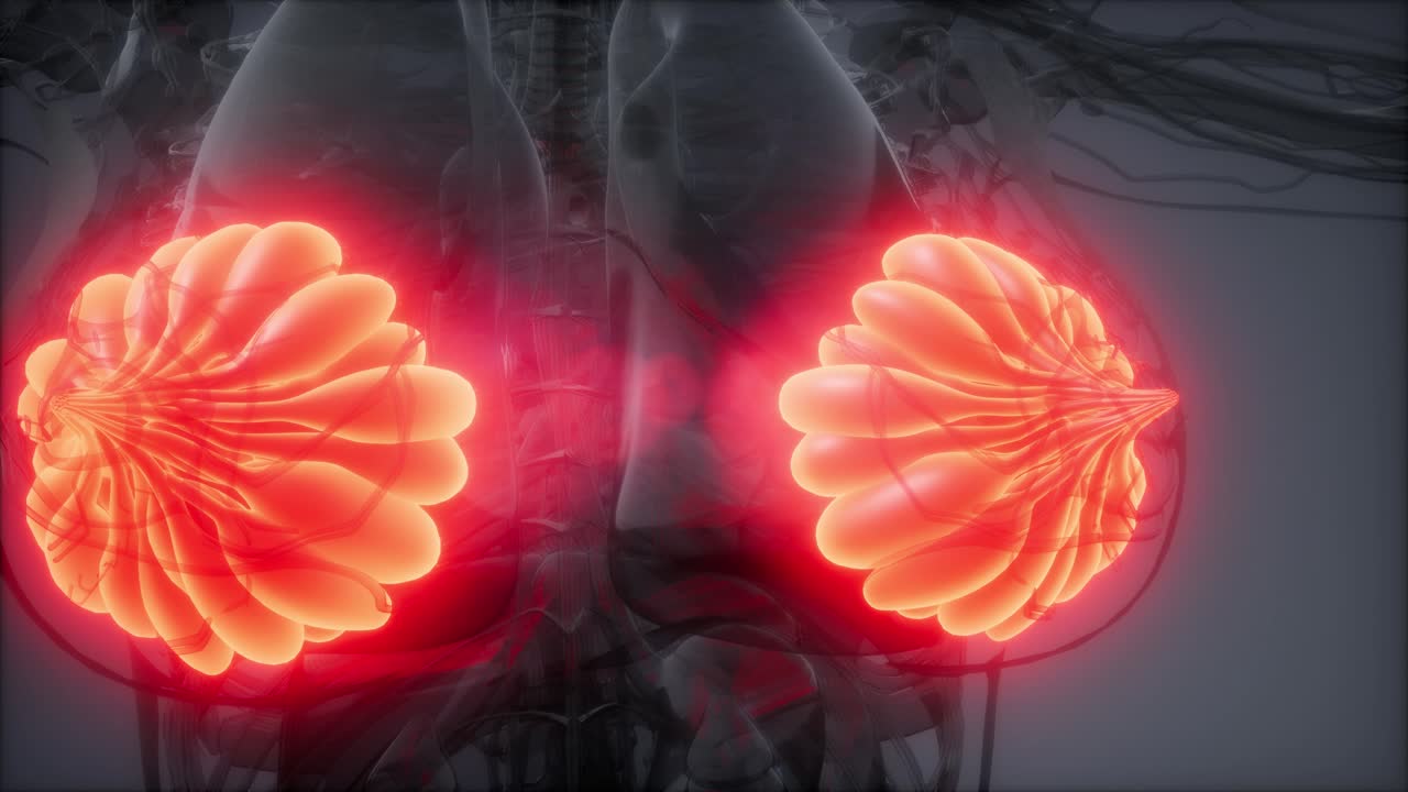 비만 여성의 유방선에 대한 의학적으로 정확한 그림