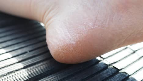 close up of a cracked and dry heel on a bare foot