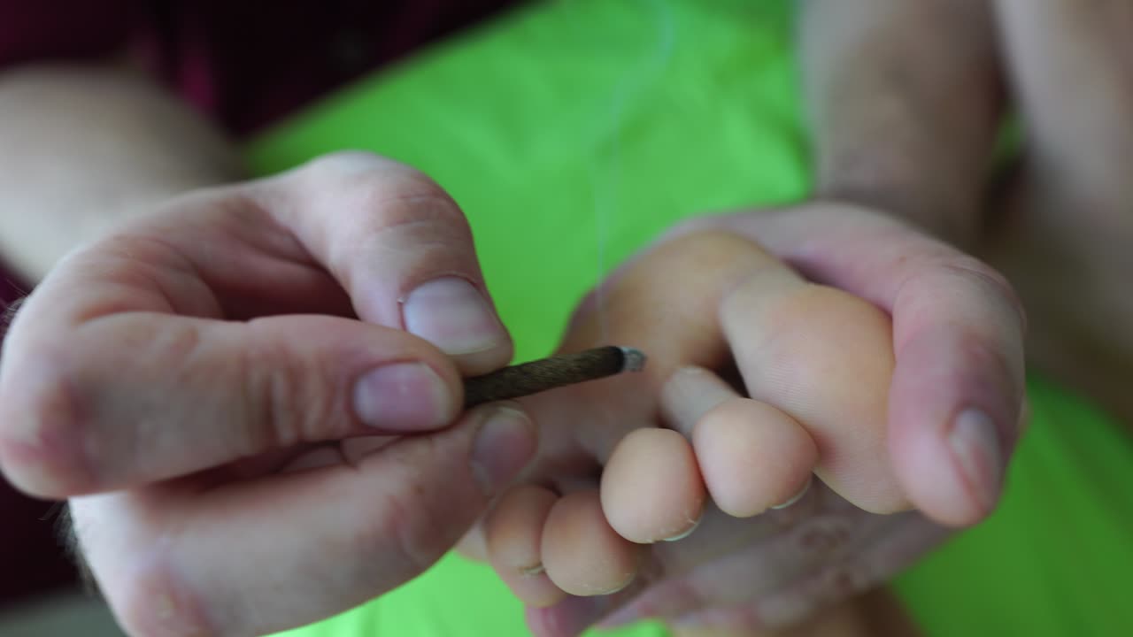 terapeuta que realiza un procedimiento de moxibustion en un centro de salud. la moxibusción es un efecto térmico en puntos biológicamente activos ubicados en toda la superficie del cuerpo humano