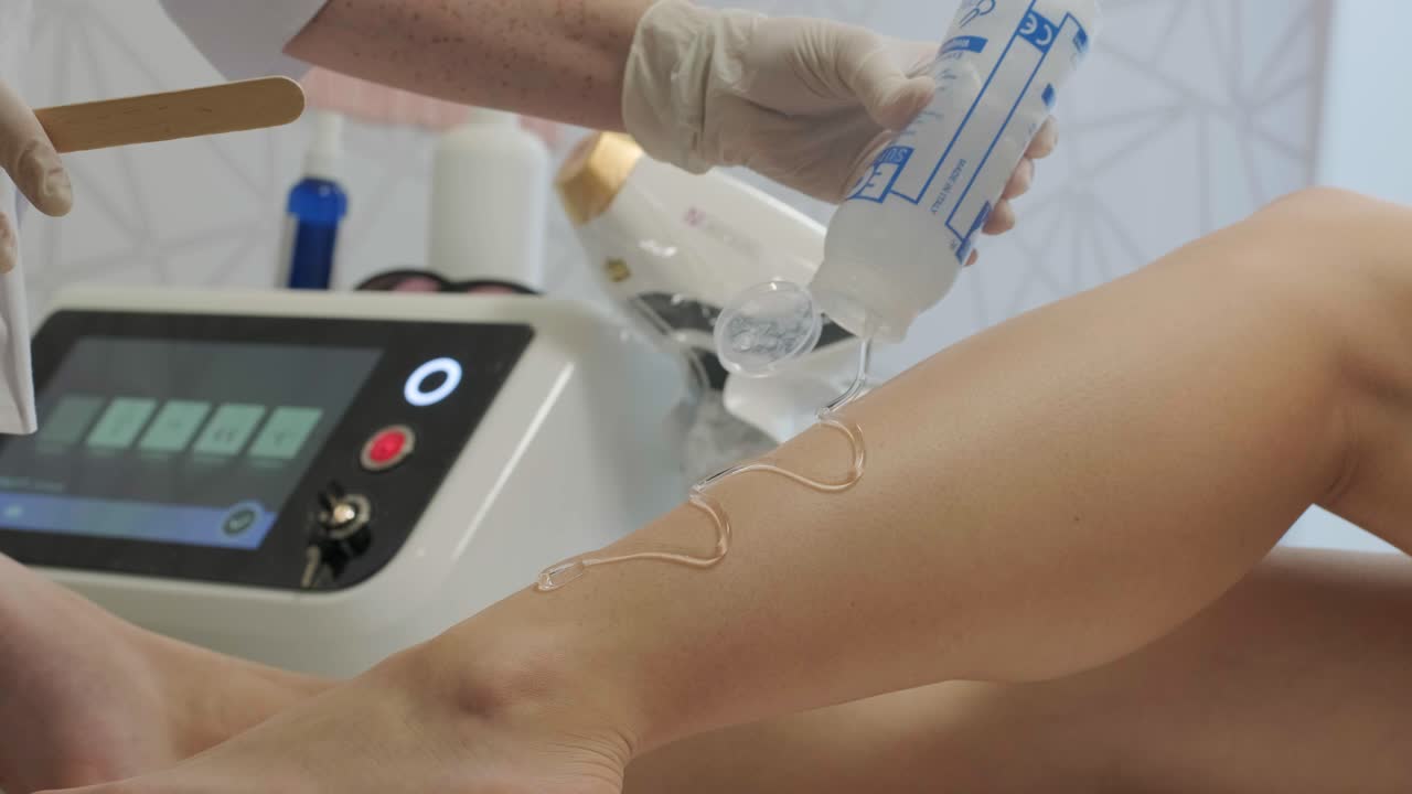 depilación láser - procedimiento de depilación. flash de depilación láser de diodo, esteticista elimina el pelo en hermosas piernas femeninas, depilación para piel lisa, procedimiento láser en un estudio de belleza o clínica, tratamiento de depilación para el cuidado del cuerpo.