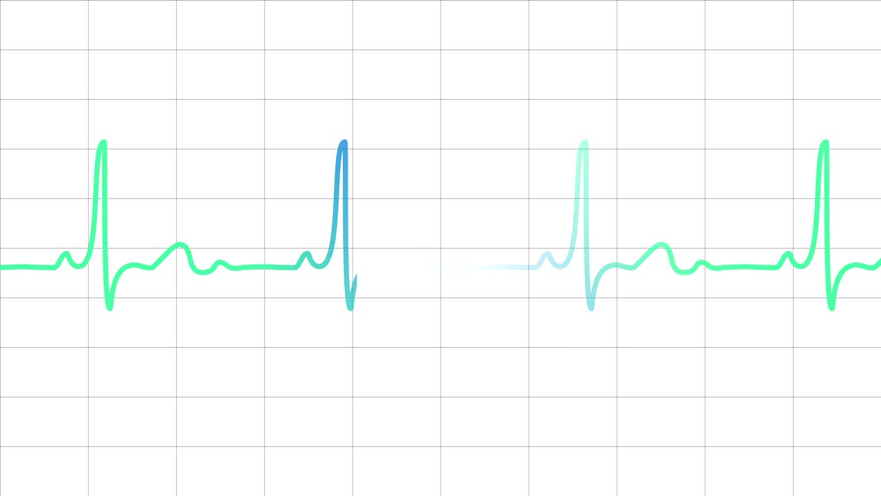 electrocardiograma monitor cardíaco pulsos en una cuadrícula blanca