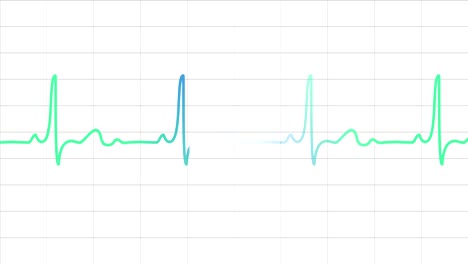 electrocardiogram heart monitor pulses on a white grid