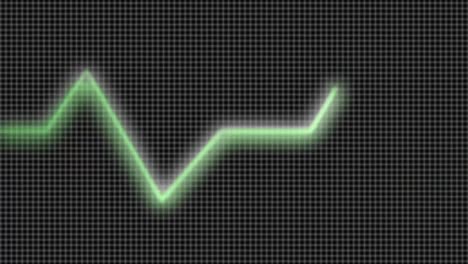 stock animation of a heart monitor