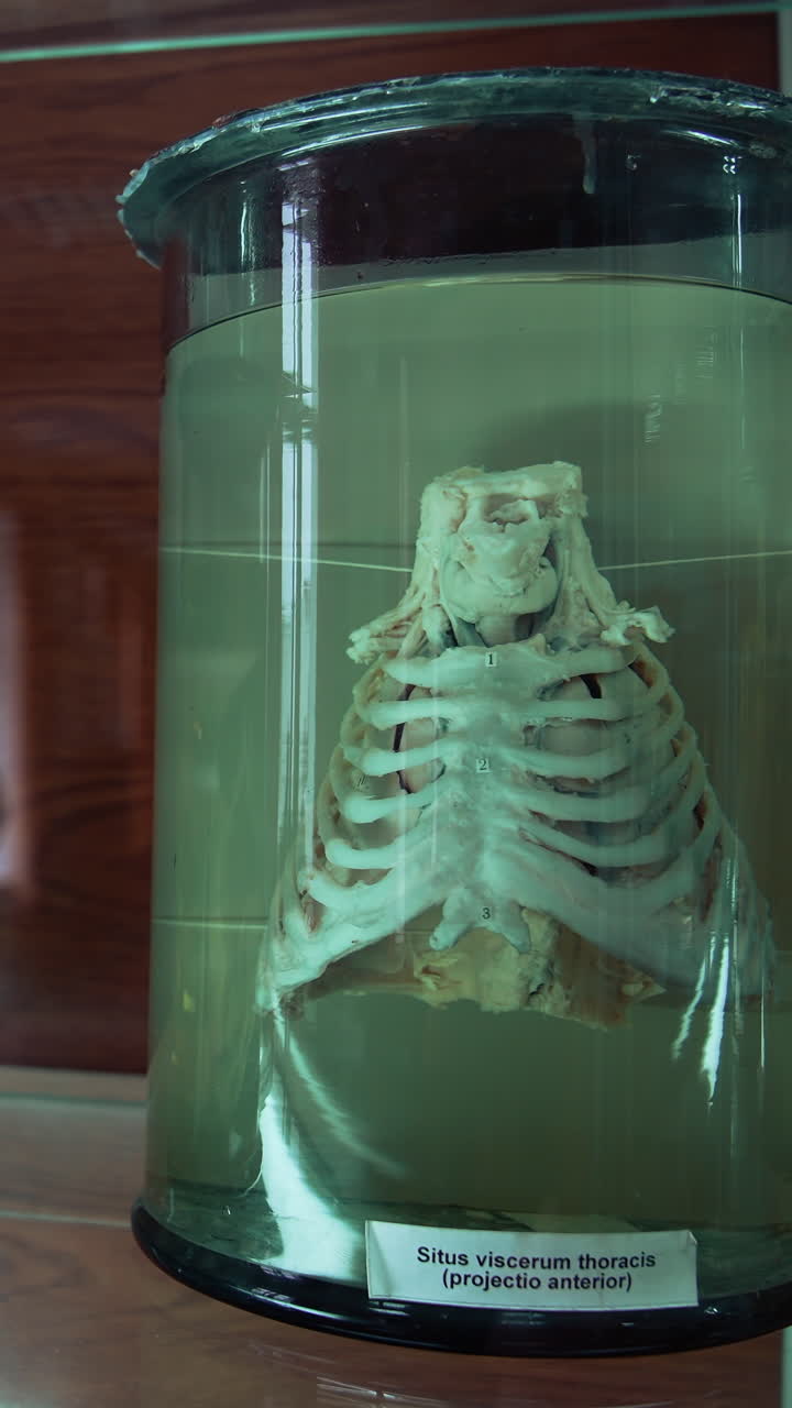 Internal organs of human in medical museum. Anatomical organs in glass tubes with formaldehyde. Vertical video