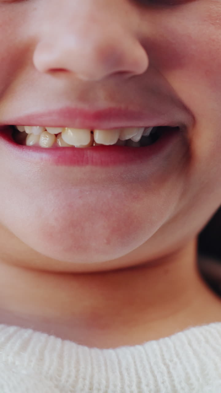 Close-up of a Happy Child's Mouth and Teeth