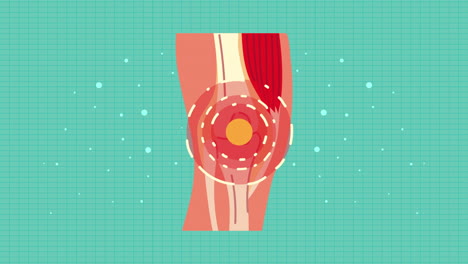 animación de la enfermedad de dolor de rodilla reumatología