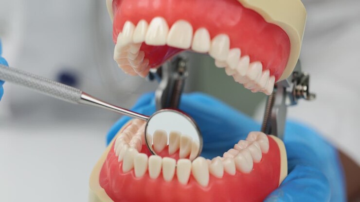Modello dentale con uno specchietto dentale che mostra denti e gengive