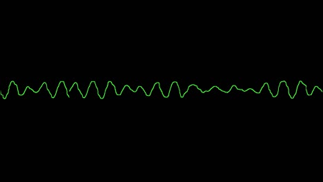 ecg shows ventricular fibrillation