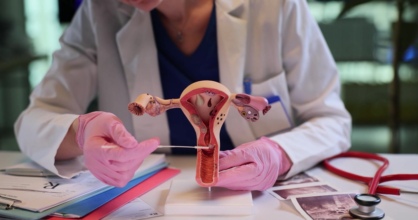 Il ginecologo tocca un modello anatomico dell'utero con un tampone.