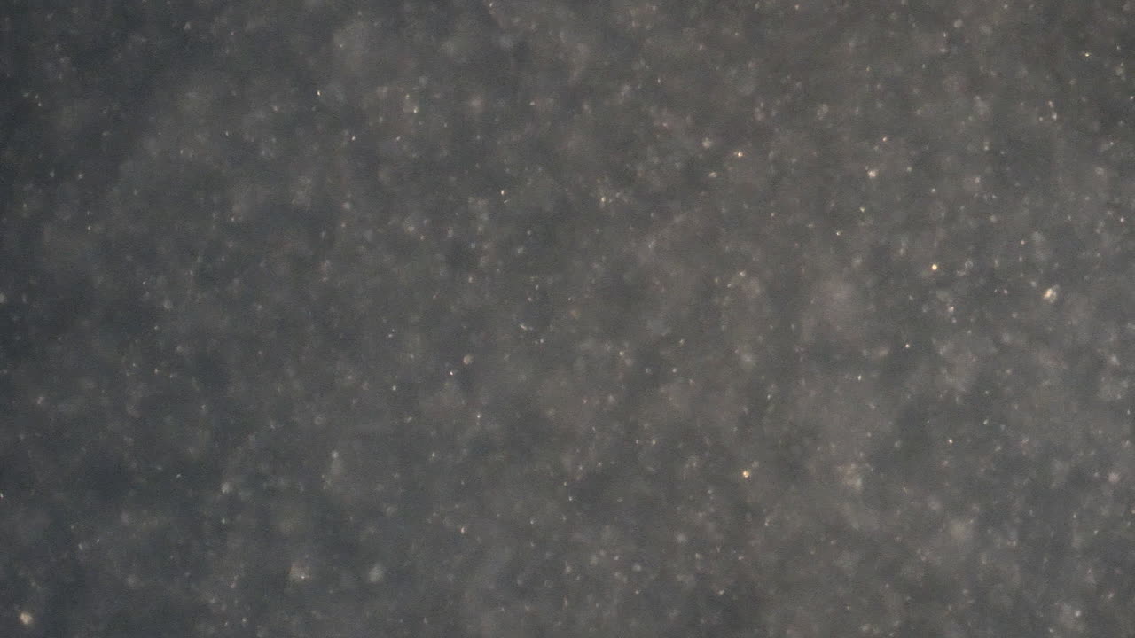 작은 정자 세포는 정액에서 움직입니다.