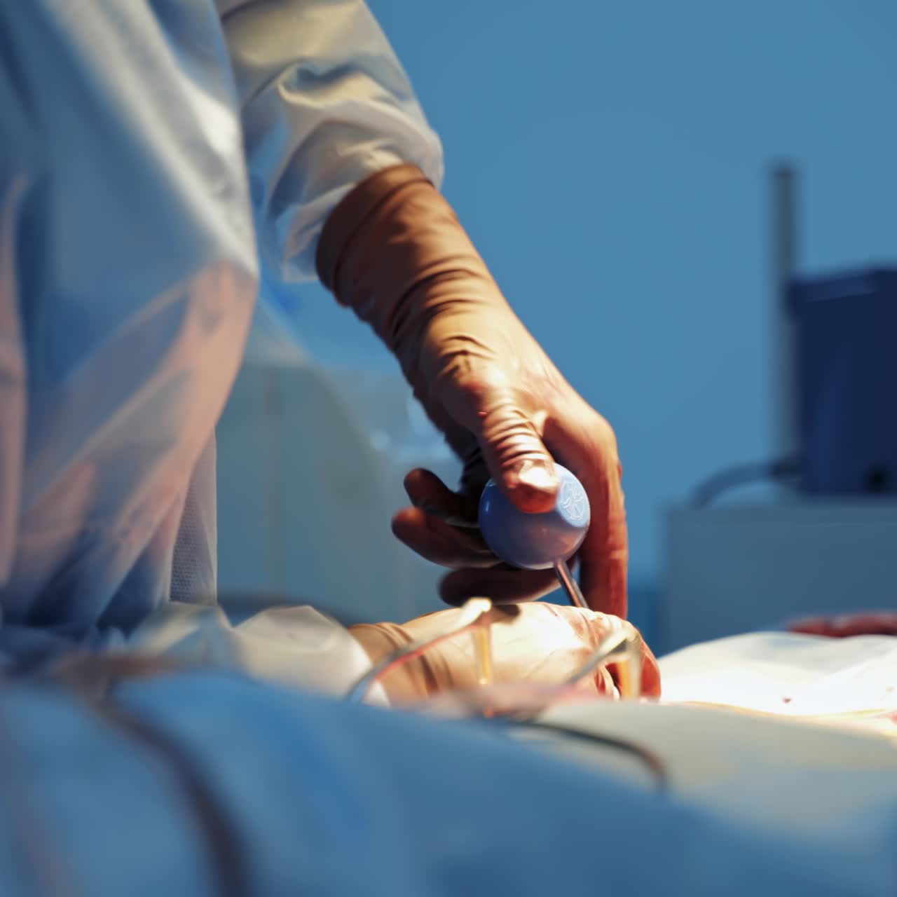 Medico in divisa blu esegue un intervento neurochirurgico. Attrezzature moderne con microscopio chirurgico sullo sfondo. Messa a fuoco selettiva. Primo piano.