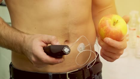 diabetic man with an insulin pump connected in his abdomen and holding the insulin pump at his hands. diabetes concept.