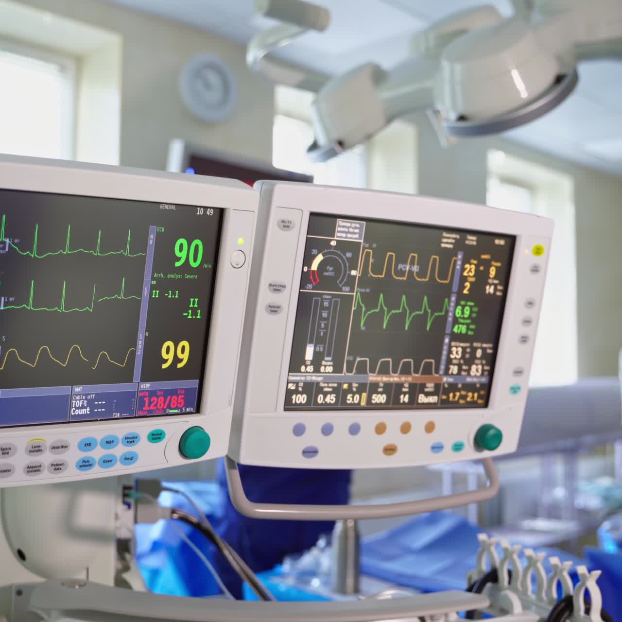 Medical monitors in the operating room. Screen of a monitor showing vital signs of a patient. Health monitor in intensive care unit