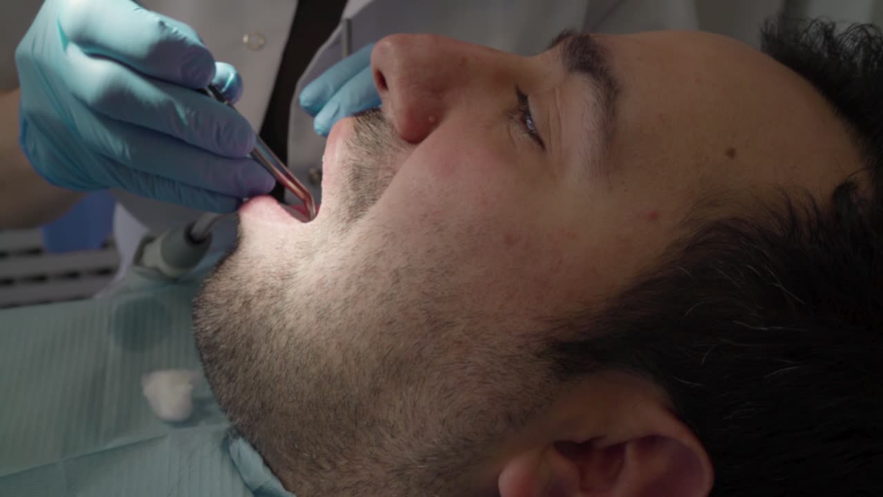 Un paziente maschio si fa otturare un dente da una dentista.