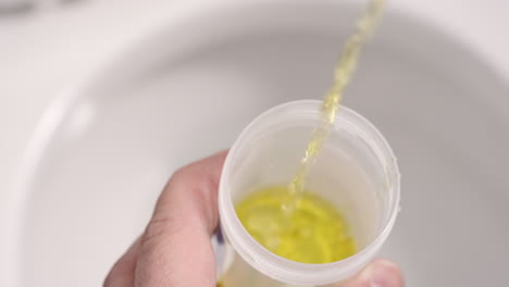 providing a urine sample for doctor visit or urinalysis drug test